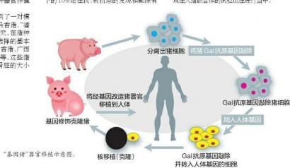 人体器官移植有望靠猪是真的吗
